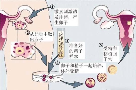 供卵的孩子-供卵宝贝:以孩子为中心的故事”