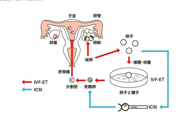 供卵和试管有什么区别(供卵与试管婴儿有什么区别?)