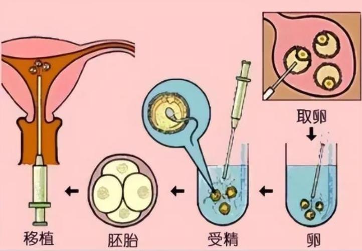供卵试管以后的弊端(供卵试管:弊端揭秘)